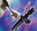 Endoscopy