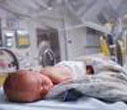 Neonatology